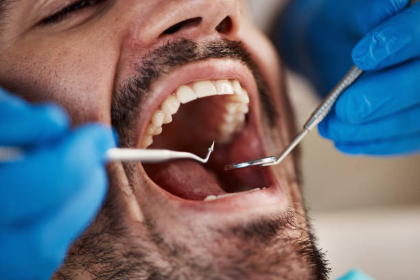 Best Dentist for Tooth Abscess  in Horace, ND